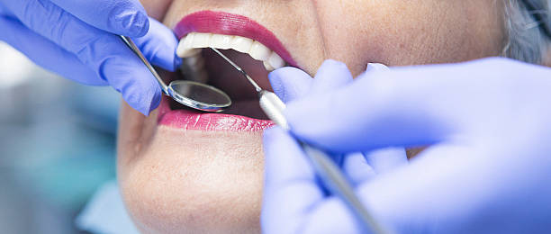 Best Emergency Dentist for Lost Fillings or Crowns in Swansea, IL